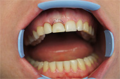 Лазерная стоматология. Стоматологическая клиника 