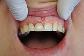 Лазерная стоматология. Стоматологическая клиника 
